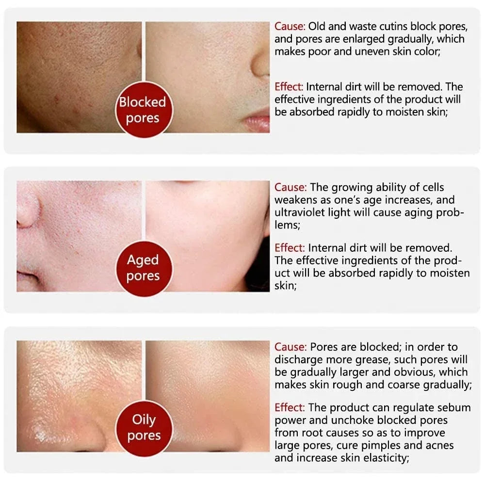 Suéro Facial con Retinol y Niacinamida – Reductor de Poros, No Comedogénico 10ml