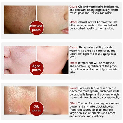 Suéro Facial con Retinol y Niacinamida – Reductor de Poros, No Comedogénico 10ml
