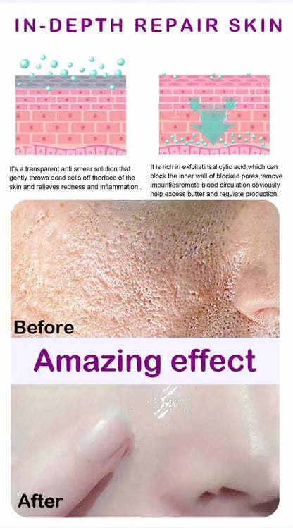 Suéro Facial con Retinol y Niacinamida – Reductor de Poros, No Comedogénico 10ml