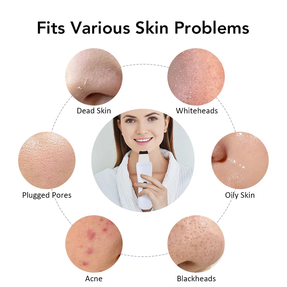 Depurador ultrasónico de la piel, espátula para la piel, limpieza Facial profunda de iones, 4 modos de levantamiento Facial, limpiador ultrasónico, dispositivo de cuidado de la piel