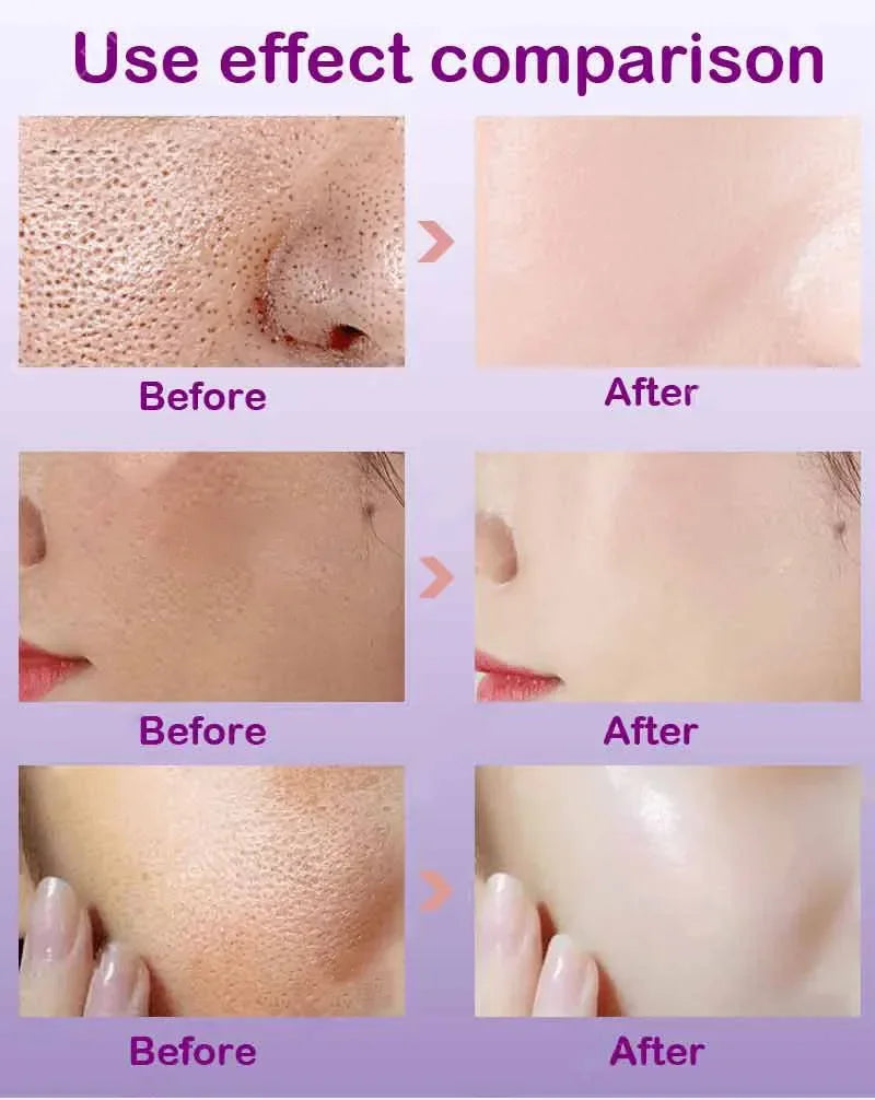 Suéro Facial con Retinol y Niacinamida – Reductor de Poros, No Comedogénico 10ml