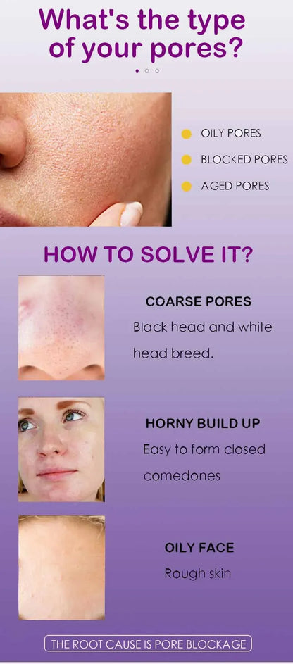 Suéro Facial con Retinol y Niacinamida – Reductor de Poros, No Comedogénico 10ml