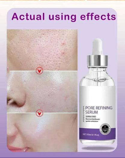 Suéro Facial con Retinol y Niacinamida – Reductor de Poros, No Comedogénico 10ml