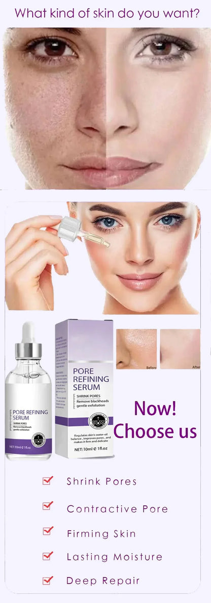 Suéro Facial con Retinol y Niacinamida – Reductor de Poros, No Comedogénico 10ml