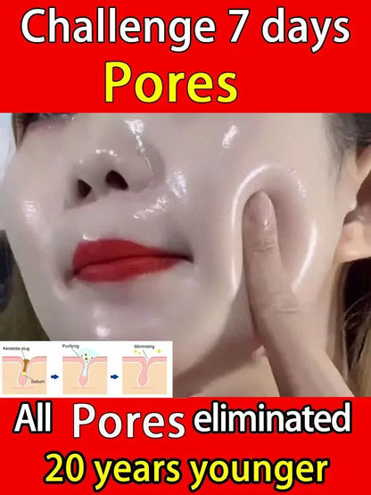 Suéro Facial con Retinol y Niacinamida – Reductor de Poros, No Comedogénico 10ml