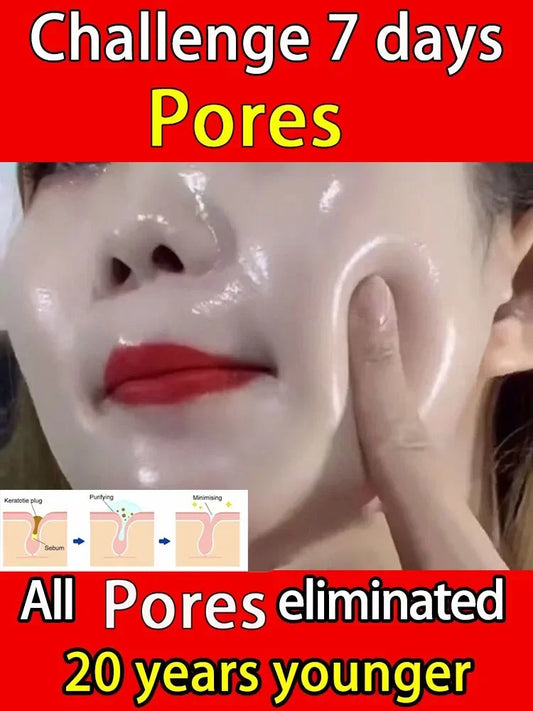 Suéro Facial con Retinol y Niacinamida – Reductor de Poros, No Comedogénico 10ml
