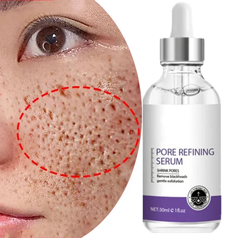 Suéro Facial con Retinol y Niacinamida – Reductor de Poros, No Comedogénico 10ml