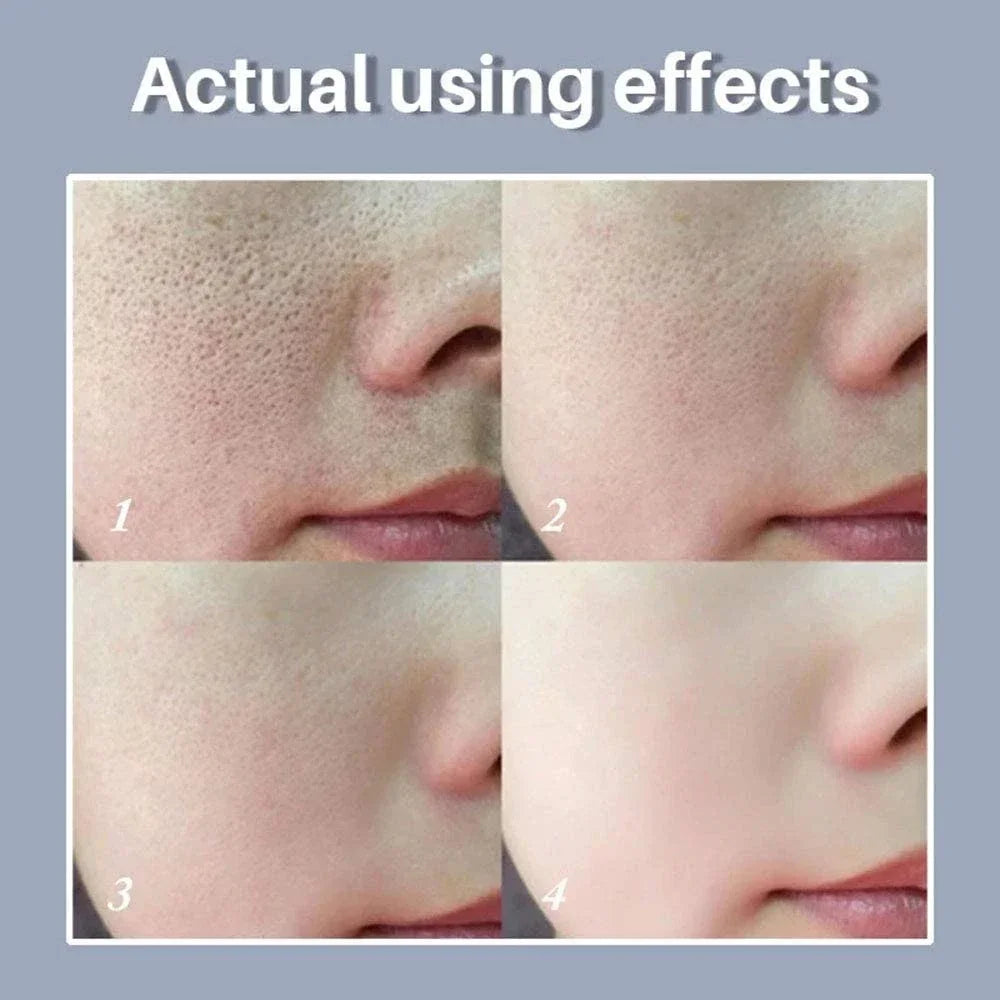Suéro Facial con Retinol y Niacinamida – Reductor de Poros, No Comedogénico 10ml